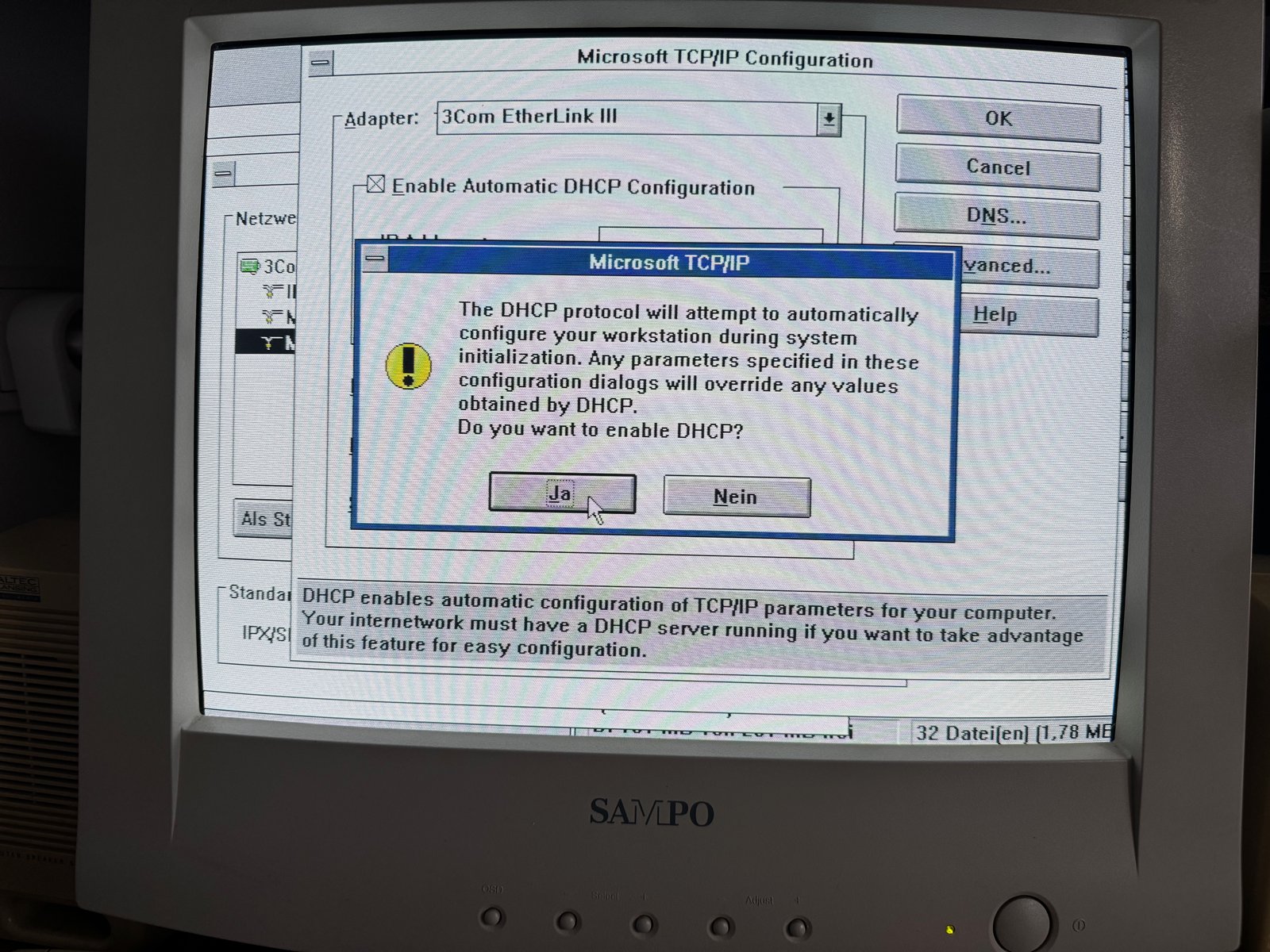 Enabling DHCP in the Microsoft TCP/IP configuration